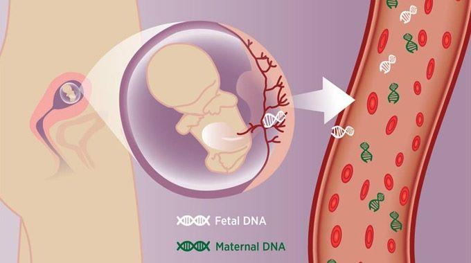 Non Invasive Prenatal Testing